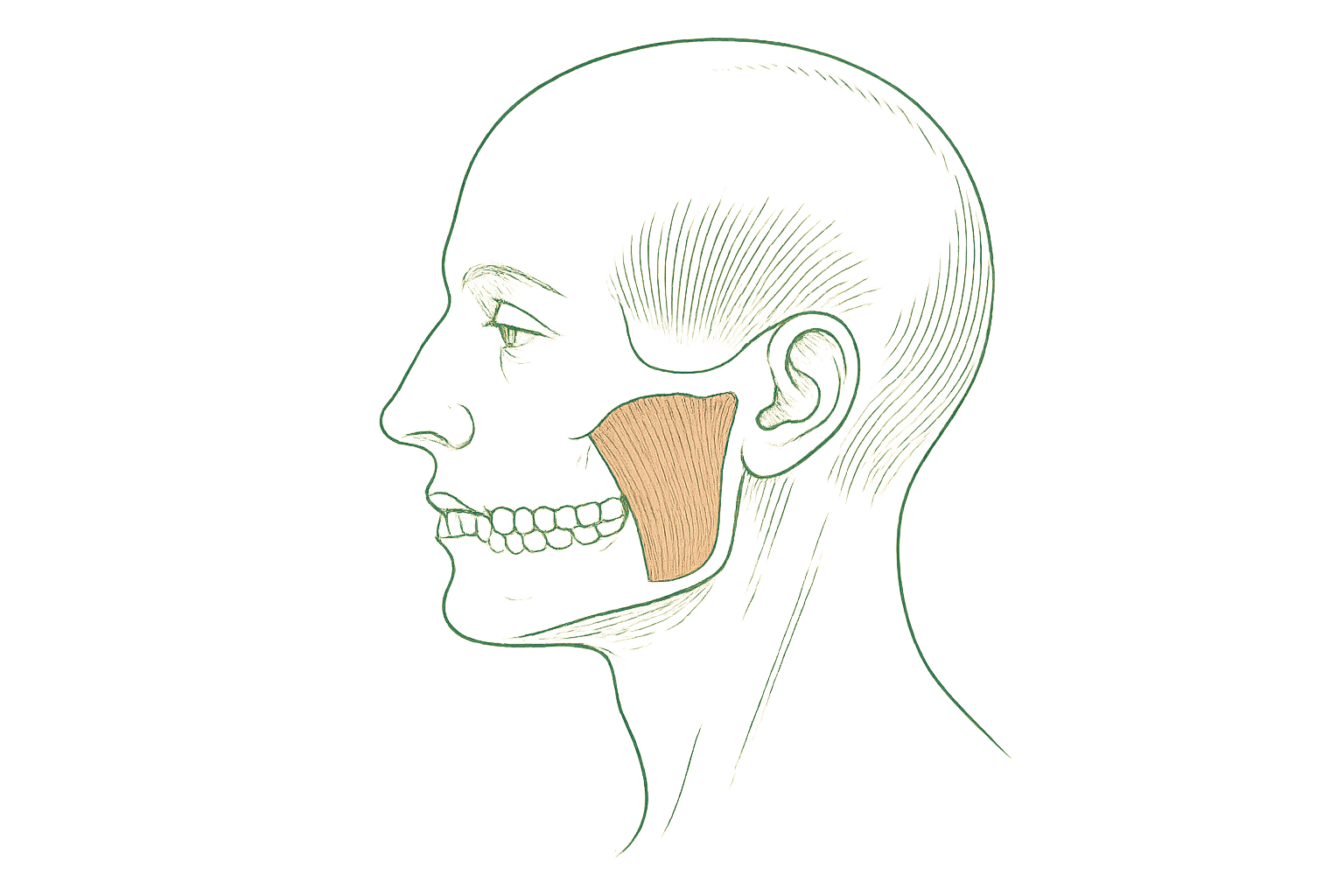 Side-profile line illustration of the jaw and masseter muscle, drawn in terracotta